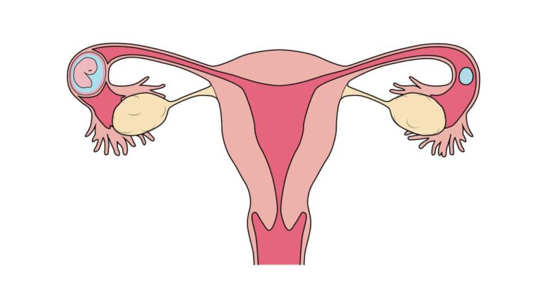 أعراض الحمل خارج الرحم ومتى تظهر