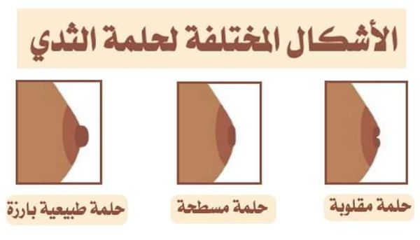 تحديد نوع الحلمة لتحضير الثدي للرضاعة الطبيعية قبل الولادة