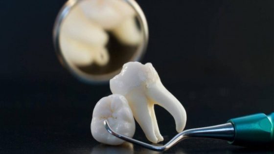 سقوط الأسنان في المنام للعزباء