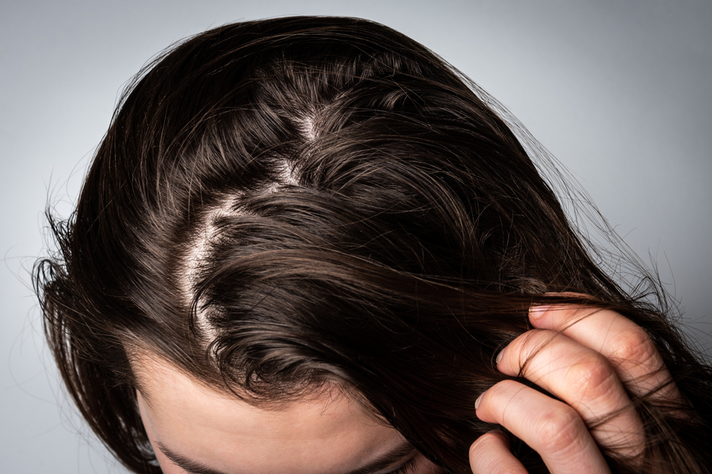 وصفات لتساقط الشعر ونصائح للتخلص من مشكلة تساقط الشعر