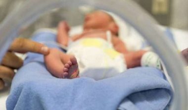 أسباب ضمور المخ عند الرضع