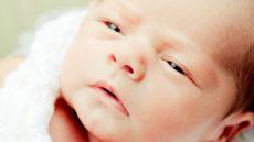 طرق الوقاية من التهاب ملتحمة العين عند الرضع