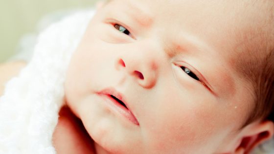 طرق الوقاية من التهاب ملتحمة العين عند الرضع