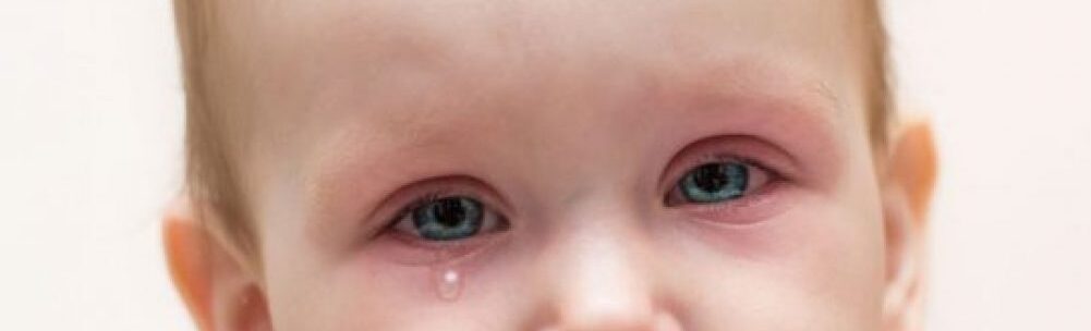 ظهور نقط حمراء حول العين عند الأطفال أسباب وعلاج
