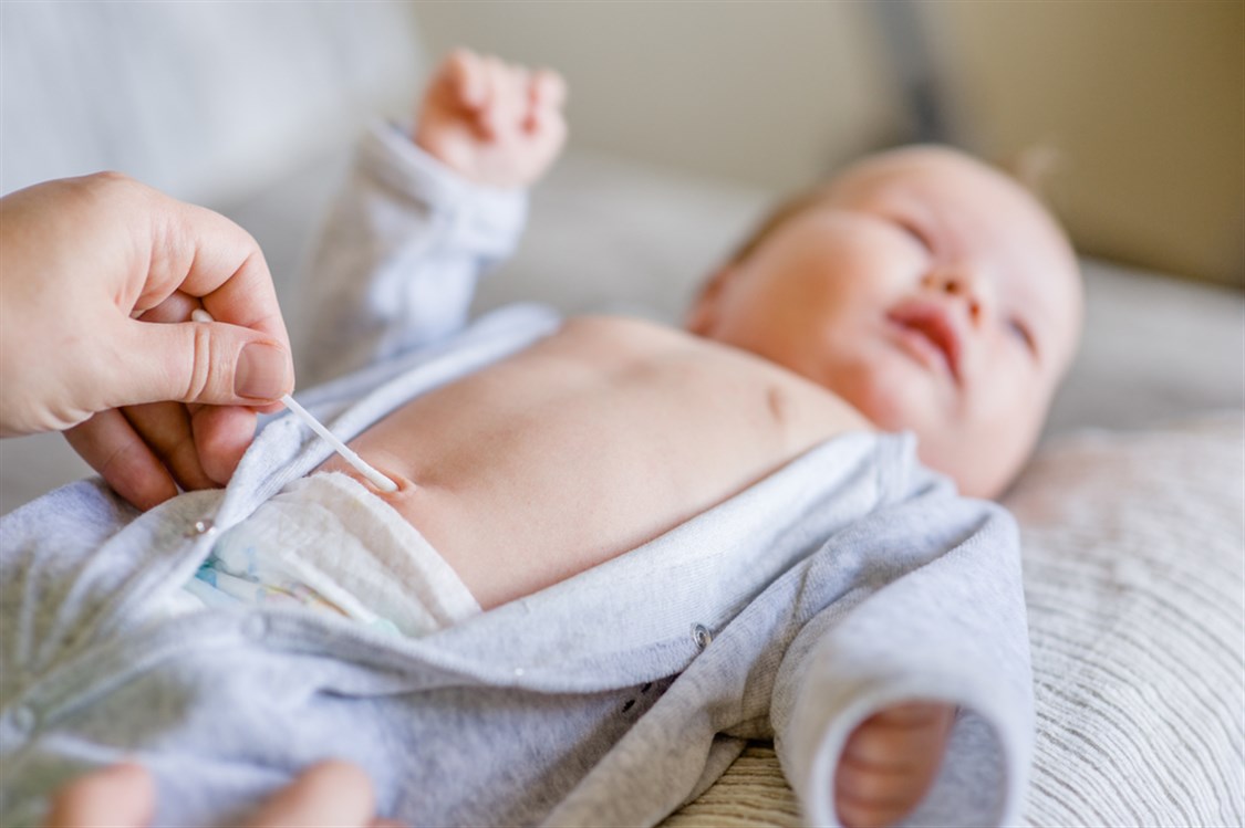 أسباب رائحة السرة الكريهة عند الأطفال الرضع