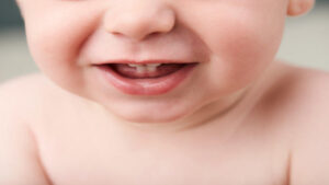 أهمية الأسنان لدى الرضع