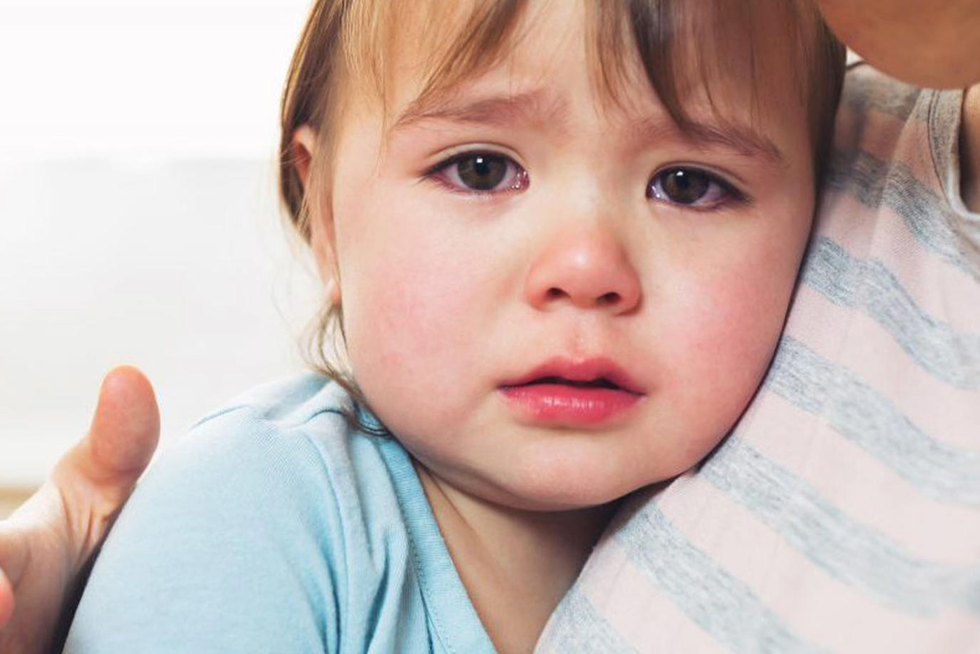 التهاب الملتحمة عند الأطفال الأسباب والعلاج