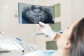 ما هي أشعة الأسنان