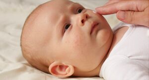 علاج أكزيما الرضع منزلياً