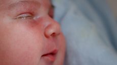 ما أسباب التهاب الملتحمة عند الرضع