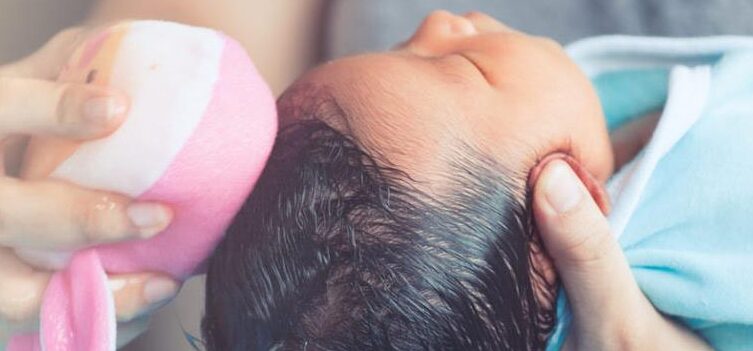 طرق للتخفيف من قبعة المهد عند الأطفال حديثي الولادة