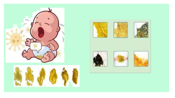 3 أنواع للإسهال عند الأطفال الرضع