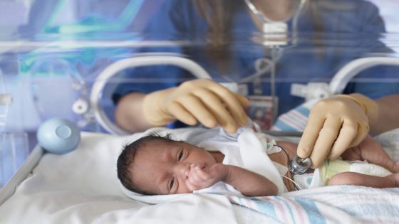 أسباب خمول الغدة الدرقية عند حديثي الولادة والرضع