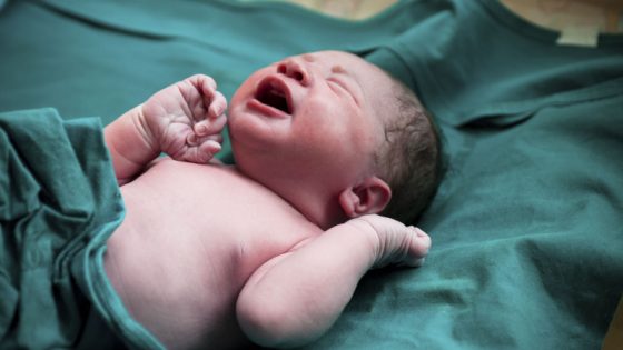الزرقة المحيطية عند الأطفال حديثي الولادة