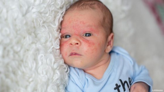 12 علامة لالتهاب السحايا عند الأطفال الرضع حديثي الولادة