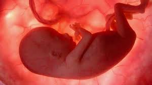 تشخيص توسع حوض الكلية عند الجنين