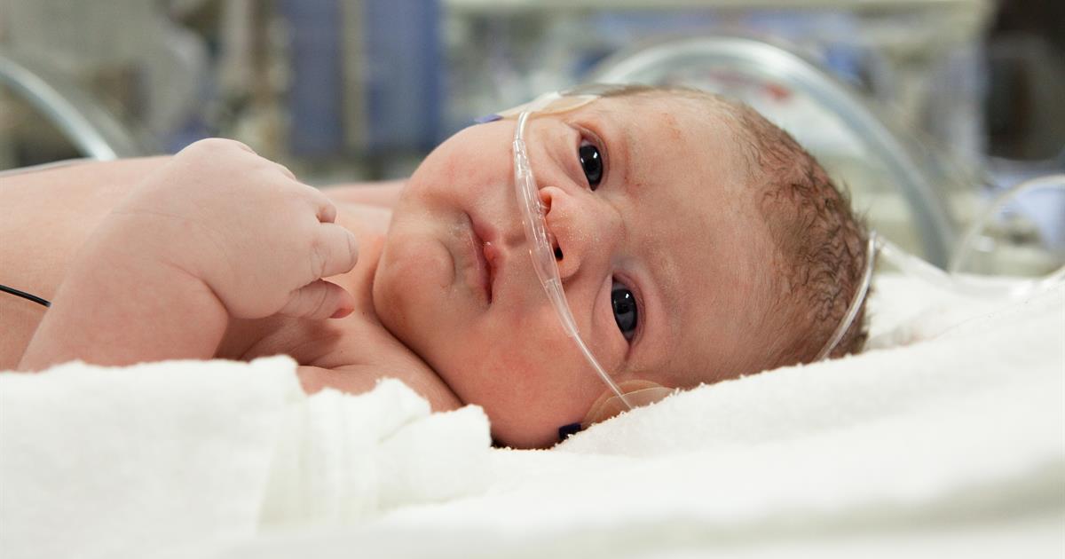 علاج ضيق التنفس عند الأطفال حديثي الولادة