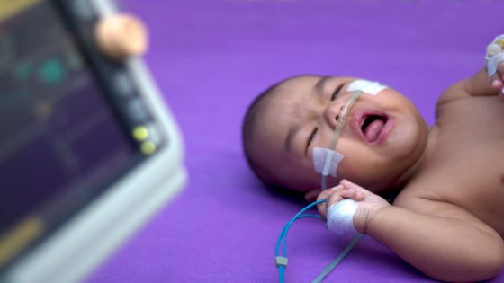 ما هي أسباب ضيق التنفس عند الأطفال حديثي الولادة