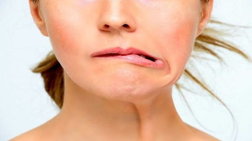 علاج مرض العصب السابع