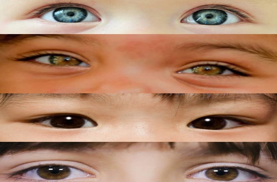 ما هي أمراض العين عند الأطفال