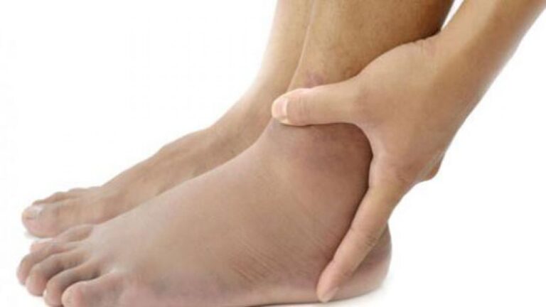 أعراض زيادة الأملاح في الجسم وطرق علاجها