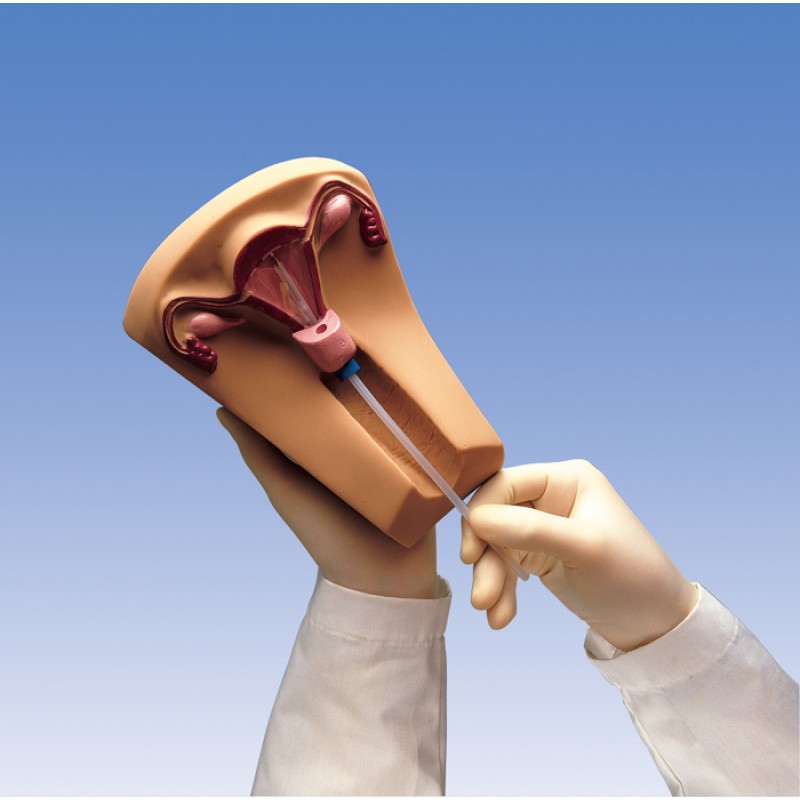 ما هي المدة التي يمكنني ترك اللولب فيها