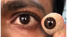 مراحل تصنيع العين الصناعية صلاحية العين الصناعية وكيفية التعامل معها