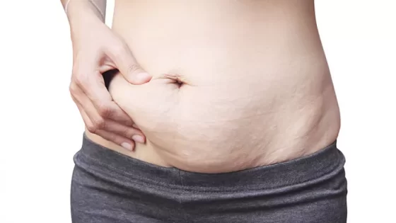 نصائح لشد جلد البطن بعد الحمل والولادة