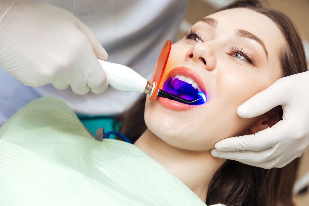 تبييض الأسنان بالليزر قبل وبعد أفضل جهاز تبييض الأسنان بالليزر
