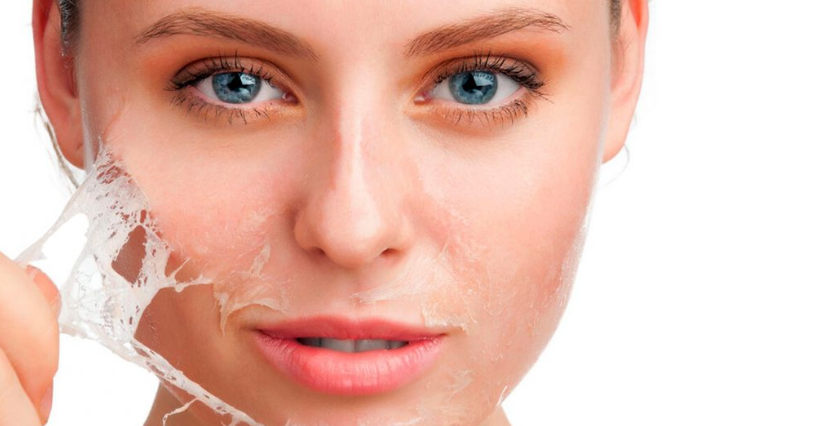 التقشير الكيميائي الفوائد والأضرار والتكلفة والأنواع
