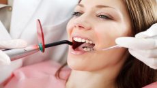 الحشوات الضوئية للأسنان المميزات والعيوب والاسعار