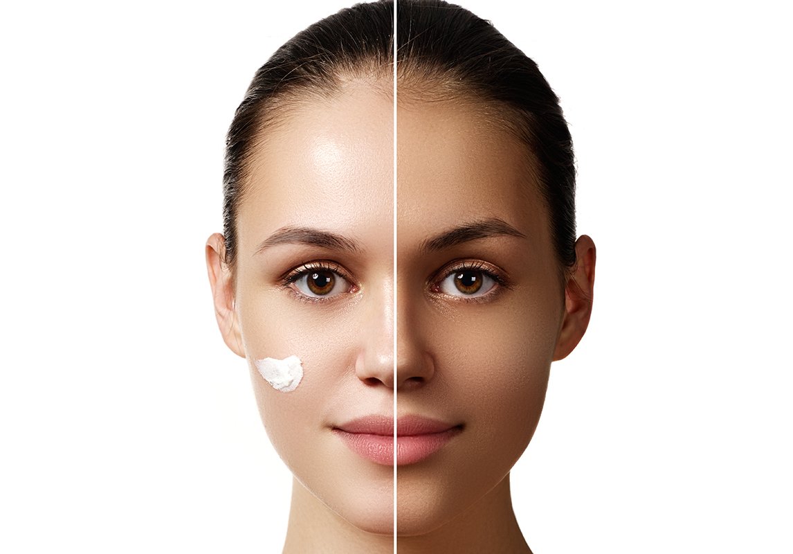 بديل كريم هاي كوين في الخلطة الثلاثية