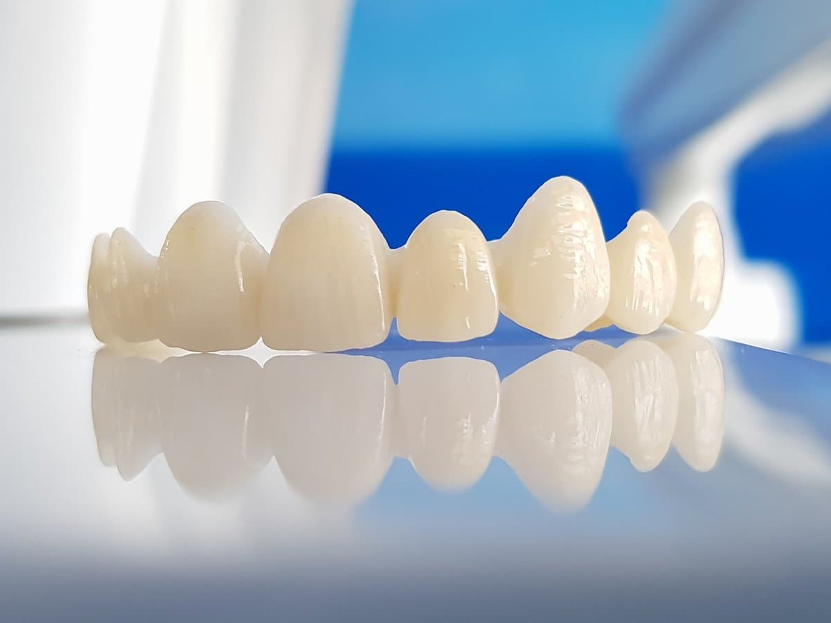 أضرار الزيركون تلبيس الأسنان والمخاطر وكم عمر تلبيسة الأسنان