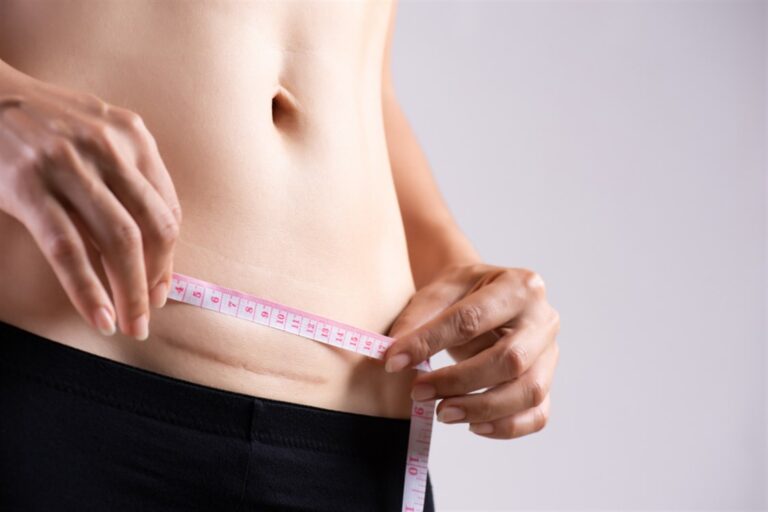 أفضل أنواع خياطة الولادة القيصرية وما هي الخياطة التجميلية