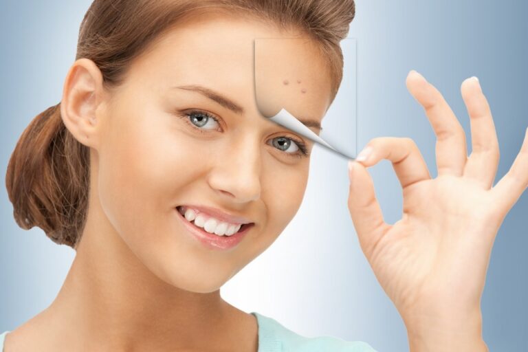تقشير COSMO PEEL