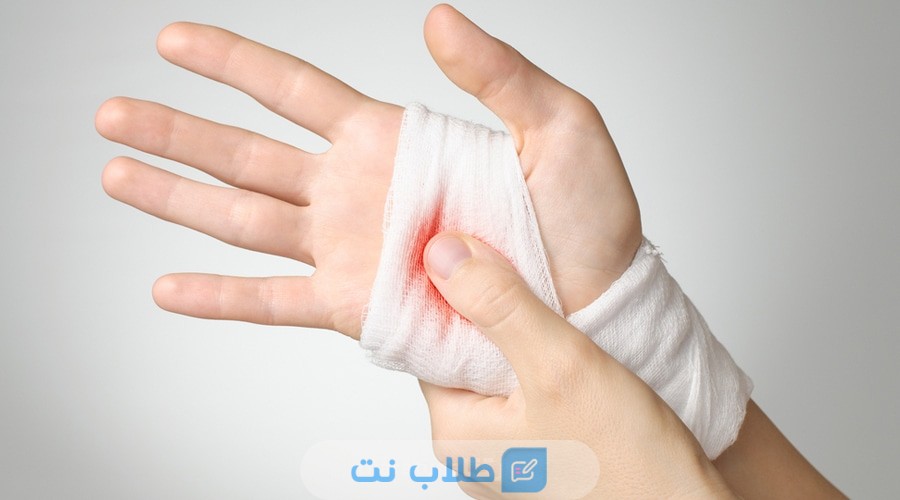 7 تعليمات هامة للعناية بالجروح ووقف النزيف