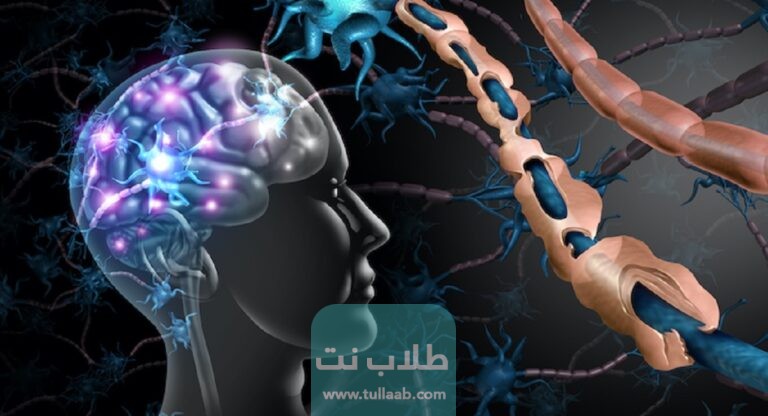 ما هو مرض التصلب اللويحي وما هي أعراضه وعلاجه
