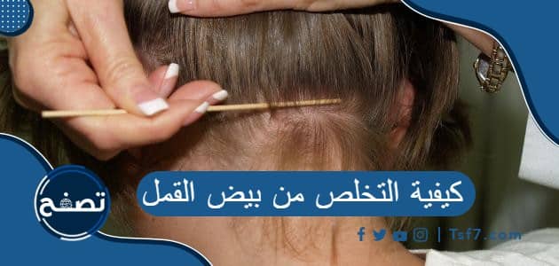 كيفية التخلص من بيض القمل وطرق الوقاية من إعادة الإصابة بالقمل