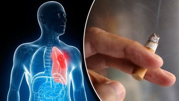 هل يسبب التدخين الشلل النصفي؟ (فيديو)